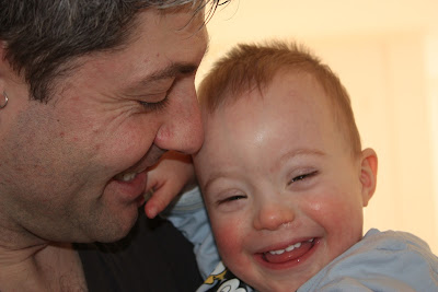 Sunny Side of Things: Gefroren