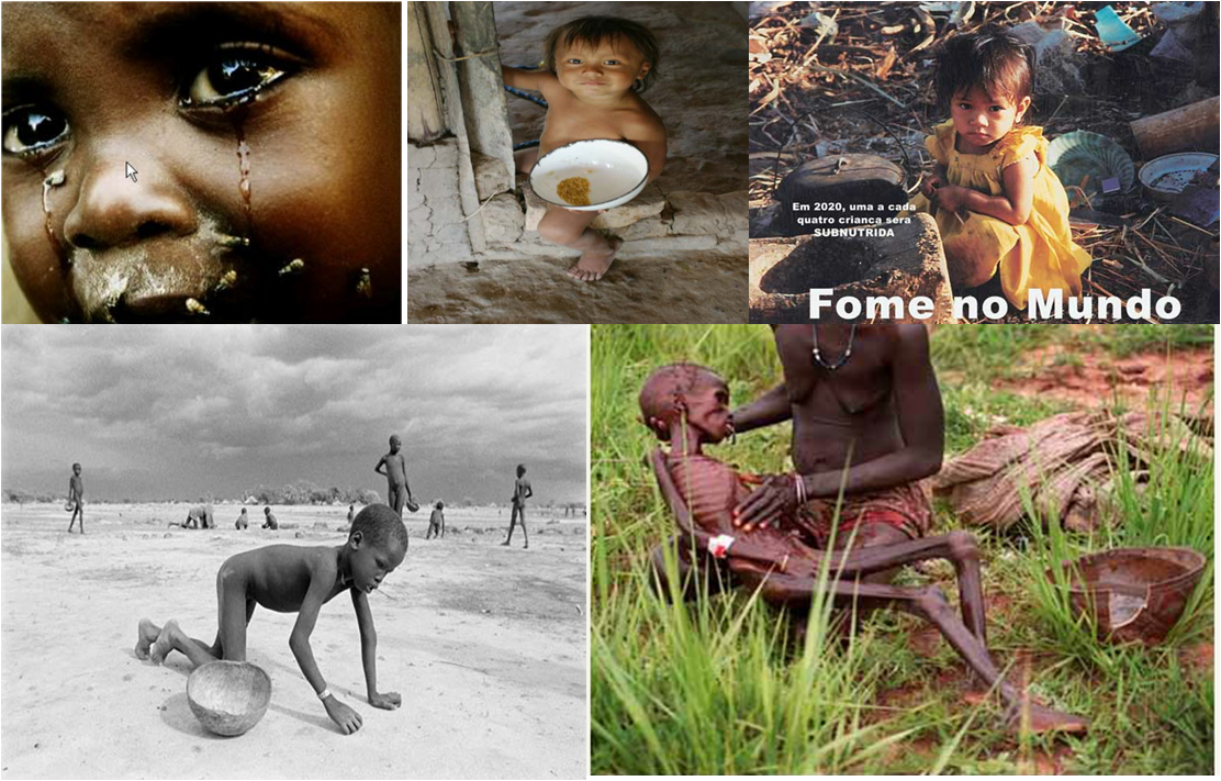 África: Somália - Fome e Dor - Eles não tem forças nem para morrer...