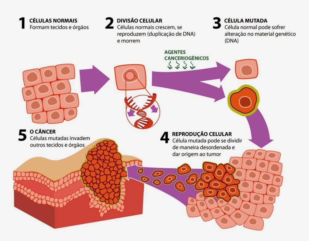 O Que é Celulas Neoplasia