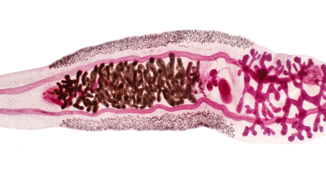 Creepy Dreadful Wonderful Parasites Case Of The Week 305