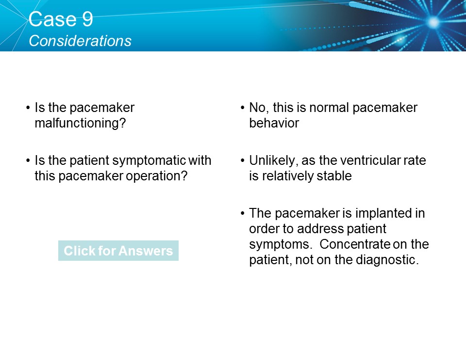 CVT Mohd Farid: Basic Pacemaker Troubleshooting Part II-Medtronic Academy
