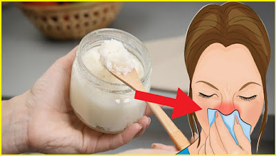 How to destroy the fungus causing your sinus pain, cure congestion, and get rid of headaches