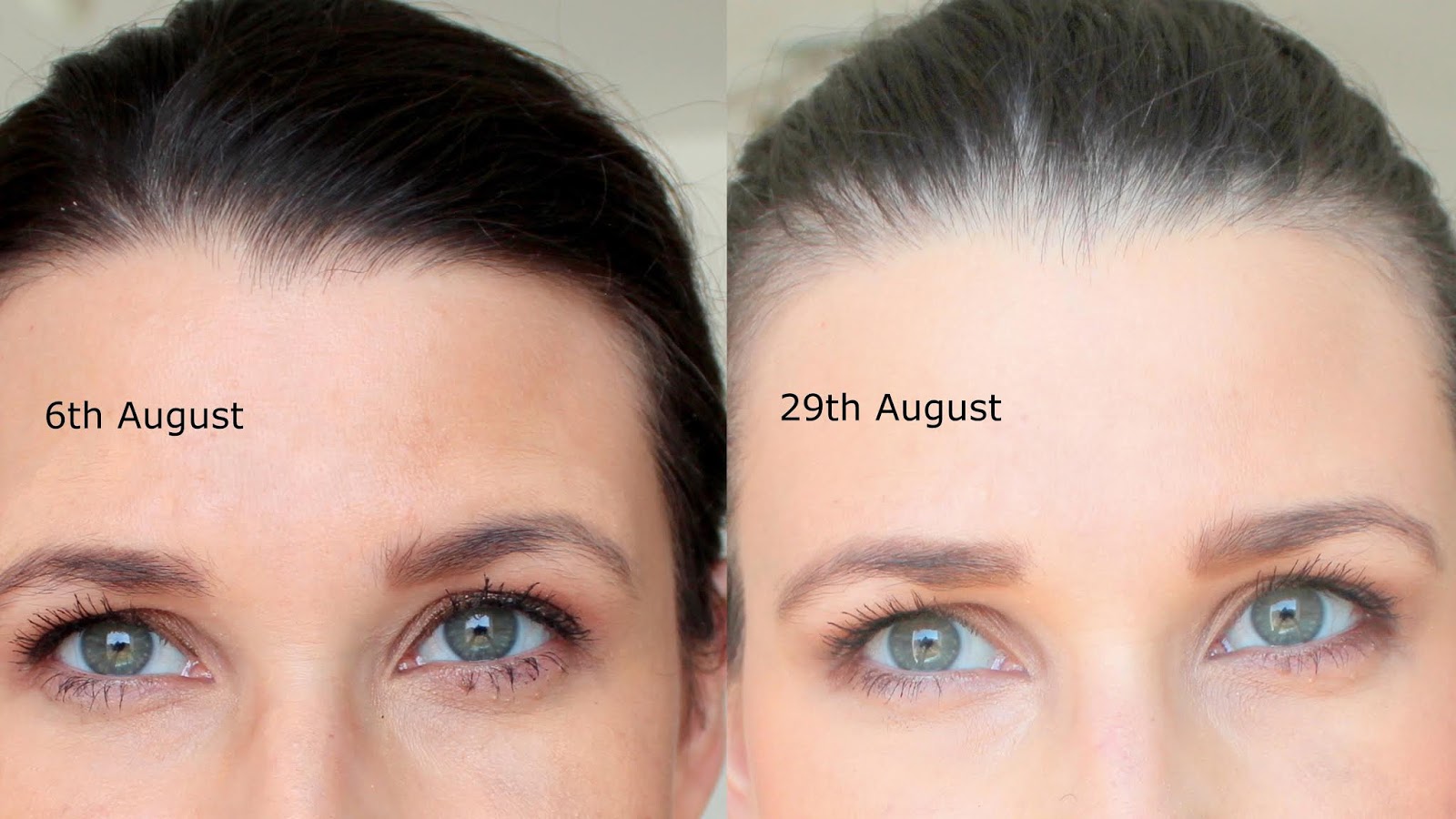 Seasonal Hair Loss. How to win the battle. / Polished Polyglot