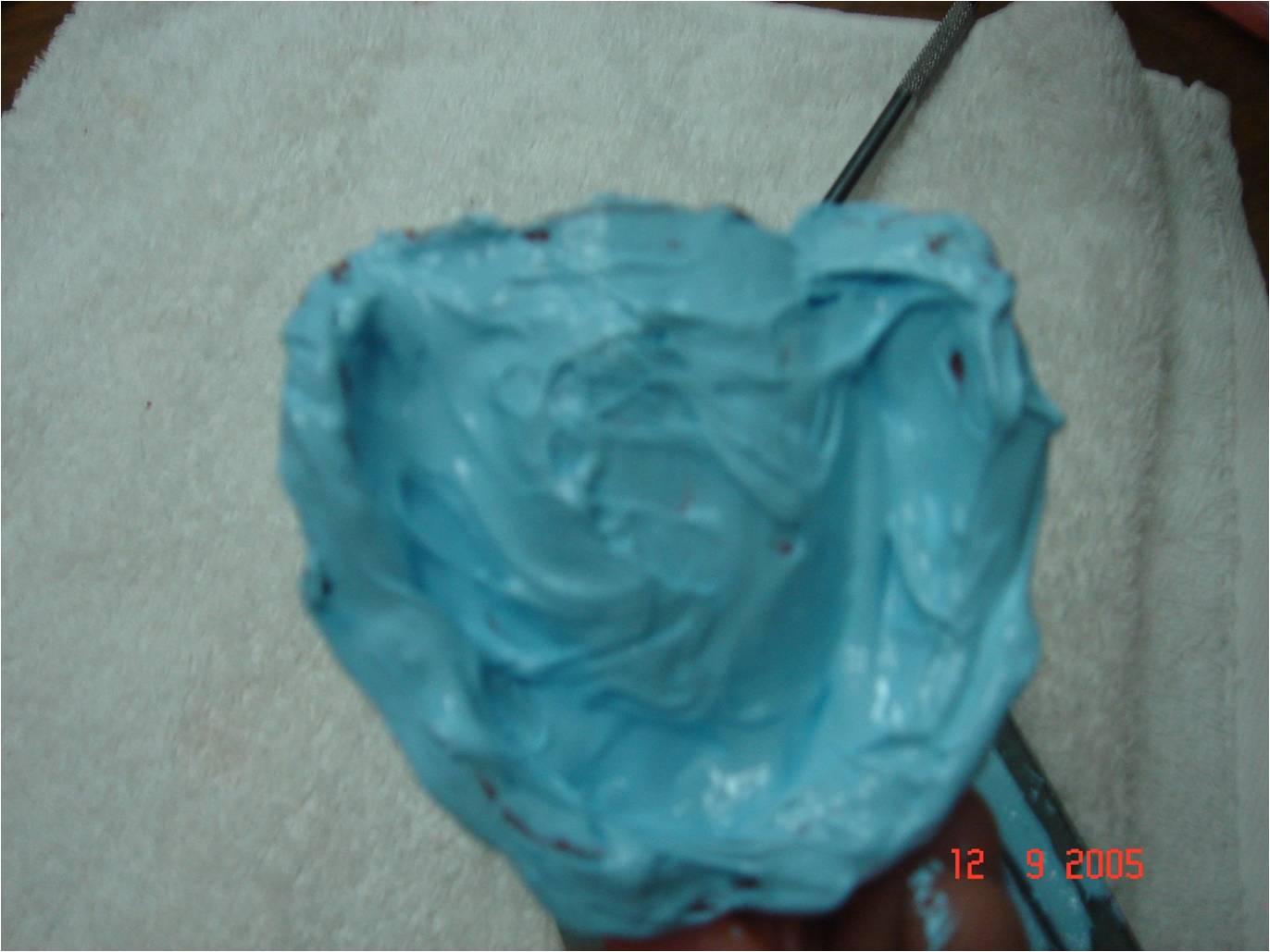 MATERIALES DENTALES FES PASTAS ZINQUENÓLICAS