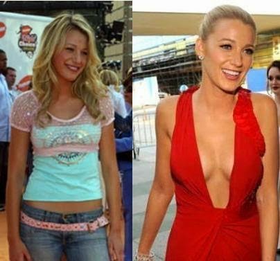Blake Lively Plastic Surgery Nose Job Breast Implants Before And After Pictures