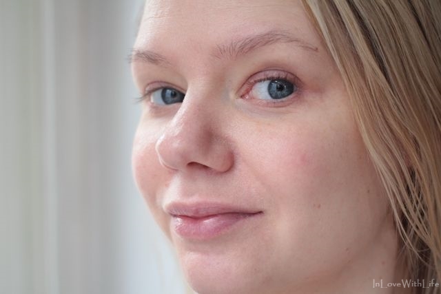 In Love With Life Faltenfrei Und Reine Haut Durch Micro Needling Ein Selbsttest Vorher