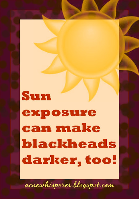 Sun exposure can make blackheads darker!  Read about it on the Acne Whisperer Blog