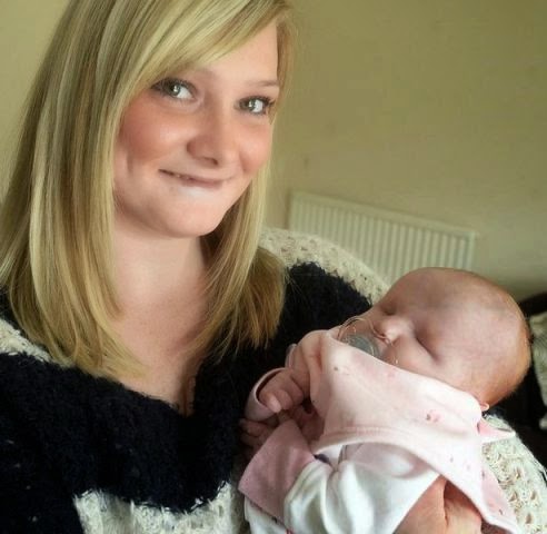 Photos: Meet the baby born with no eyes | iTz......STRICTLY