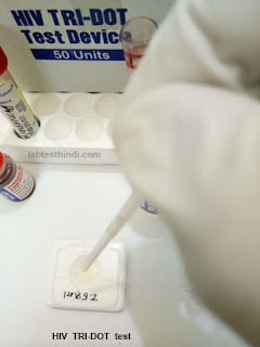 HIV test - Add Serum or Plasma