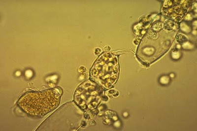 Chytridiomycota: Pengertian, Ciri, Struktur Tubuh, Contoh 