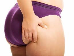 CARA MENGATASI GATAL DAN BINTIK MERAH DI BOKONG WANITA CARA MENGATASI GATAL DAN BINTIK MERAH DI BOKONG WANITA