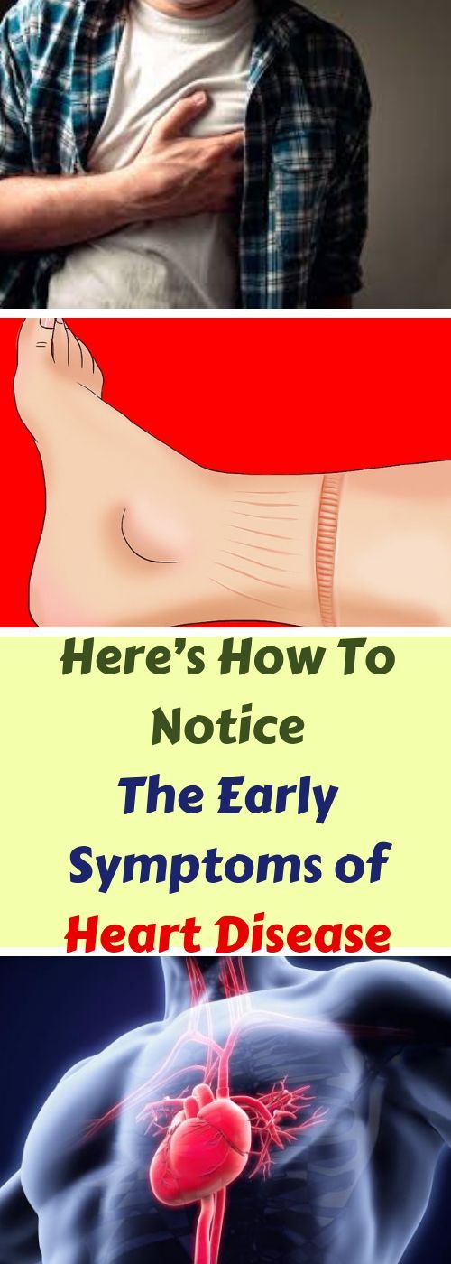 Let Start Slim Today Here’s How To Notice The Early Symptoms Of Heart
