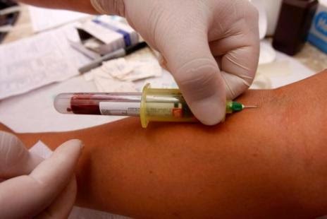 Anticuerpos anti-citomegalovirus igg positivo que significa
