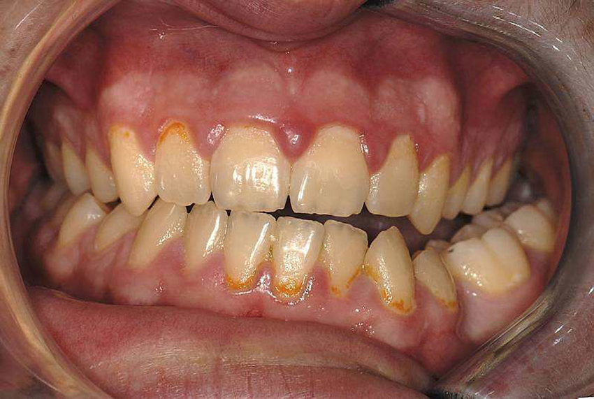 Plastic and Cosmetic Surgery Correction of Dentofacial Deformities at