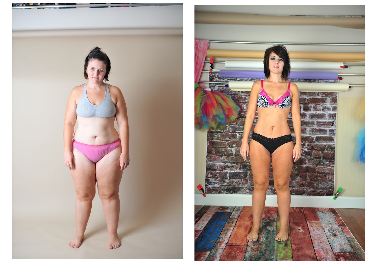 My Weight Loss Journey VSG Before/After pics 11 months out