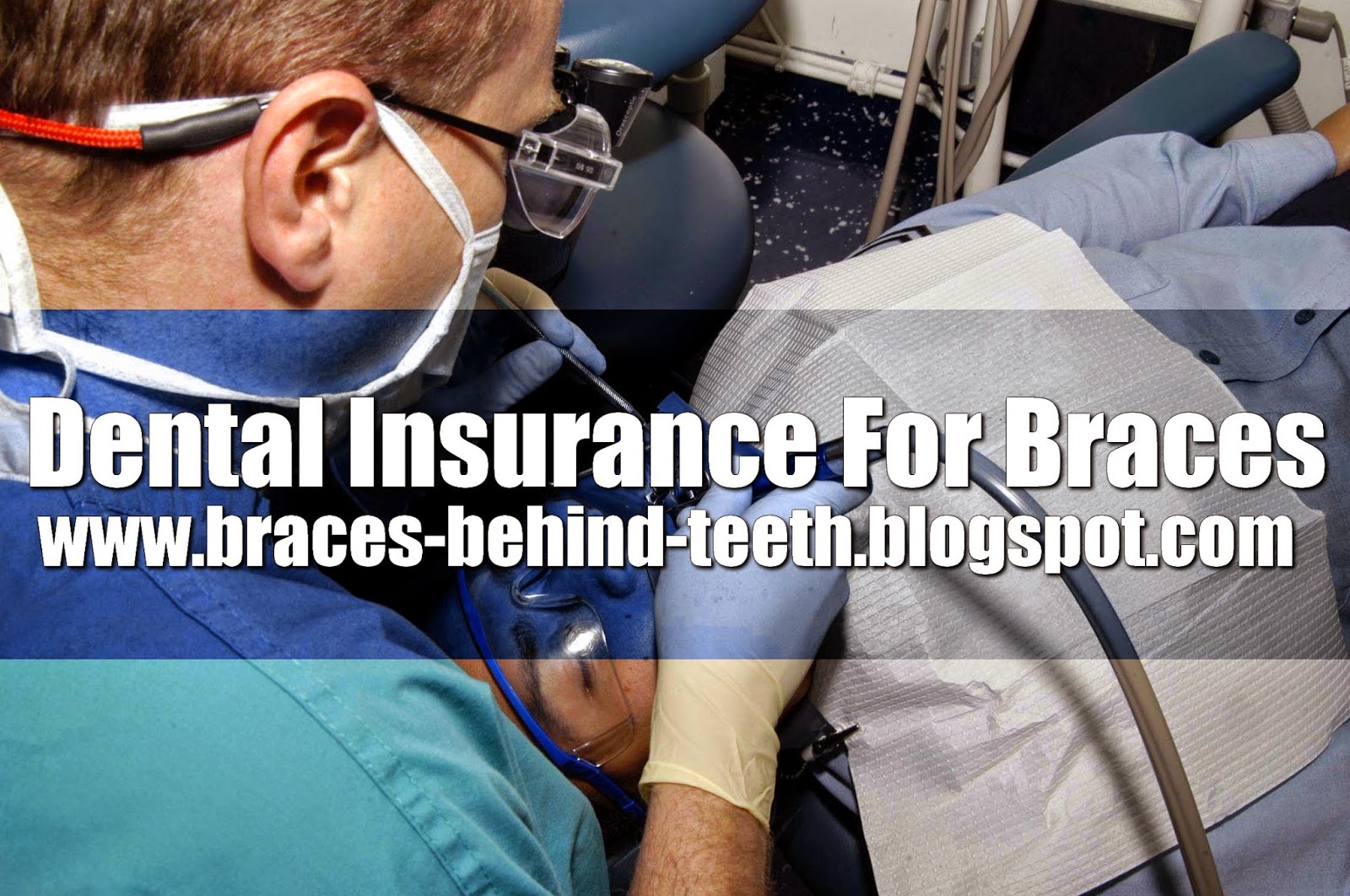 Dental Insurance: Dental Insurance For Braces