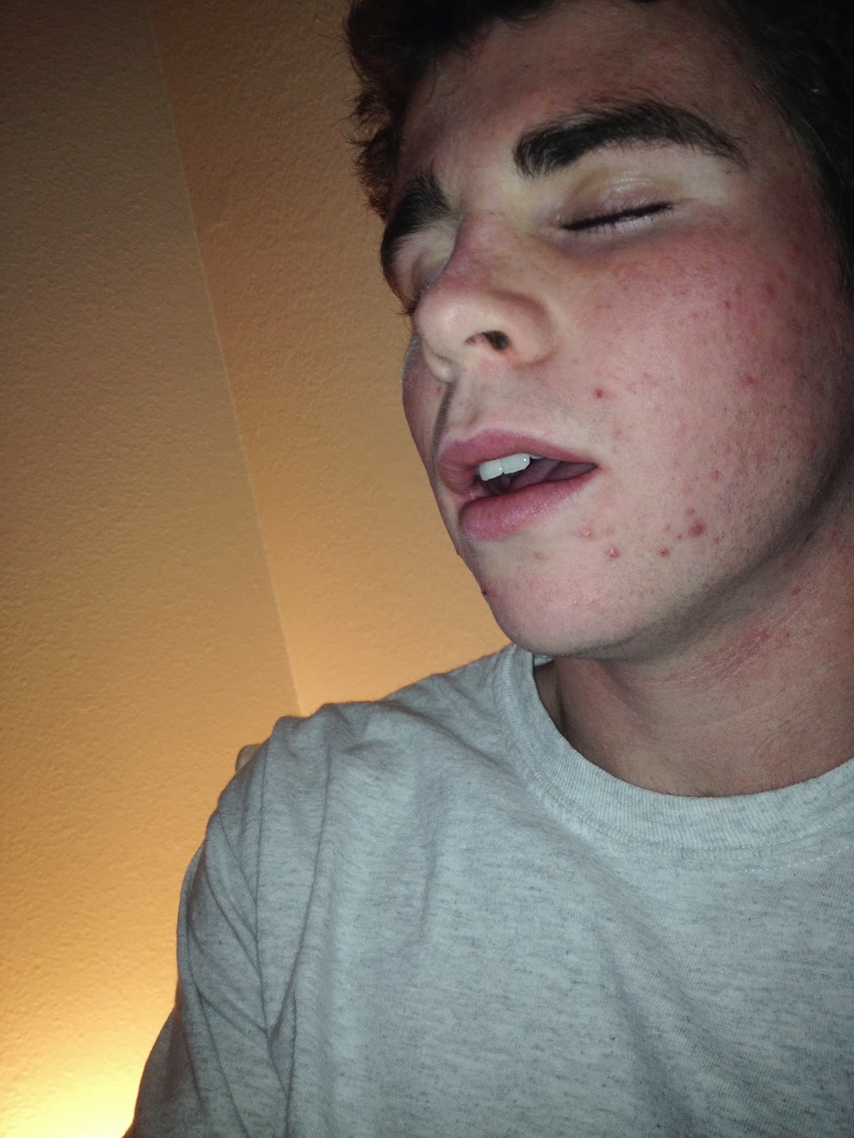 Accutane Cheap Online