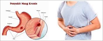 Мааг магазин одежды. Maag вектор. Заменившие zara магазины maag. Zara открывается в россии. Zara открывается в россии.