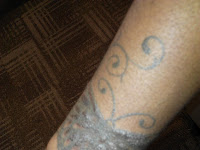 Black Tattoo Healing Pictures