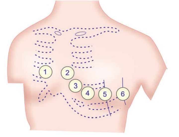 Physiology Of Ecg Ecg Terminologies Explained Physiology Notes