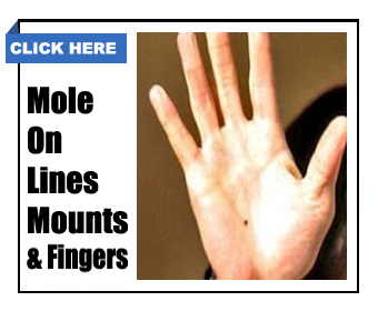  mole on hand