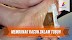 Cara Sederhana Membuang Semua Racun di Dalam Tubuh