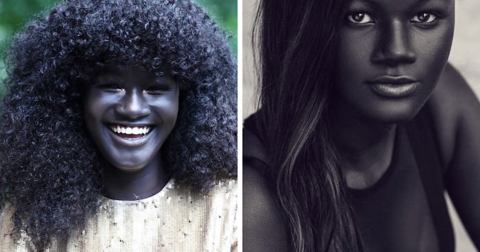 Teen Bullied For Her Incredibly Dark Skin Color Becomes A Model, Takes The Internet By Storm Teen Bullied For Her Incredibly Dark Skin Color Becomes A Model, Takes The Internet By Storm