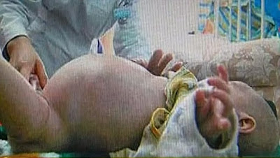 pregnant boy gives birth