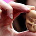 Decisão do STF sobre aborto provoca reações controversas no RN