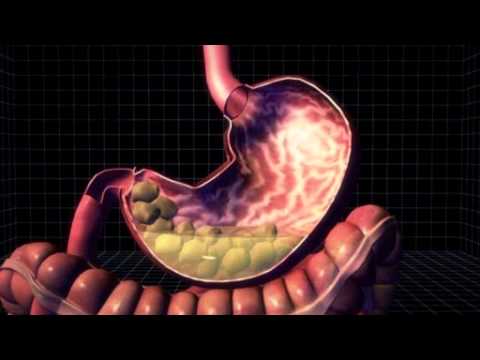 Beauty And The Watermelon The Cotton Ball Diet