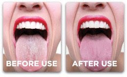 10 Tips Penjagaan Gigi Ke Tahap Yang Lebih Baik