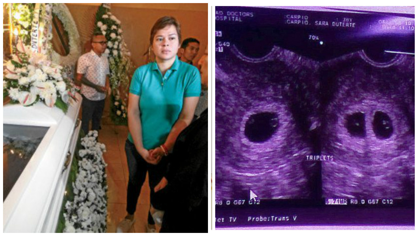 Sara Duterte loses two of unborn triplets following stressful Davao blast