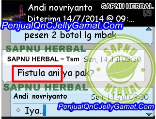 Cara Cepat Menyembuhkan Fistula Ani Tanpa Operasi Cara Cepat Menyembuhkan Fistula Ani Tanpa Operasi