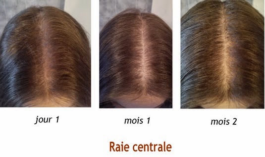 Les Vicissitudes D Une Aag Octobre 2014