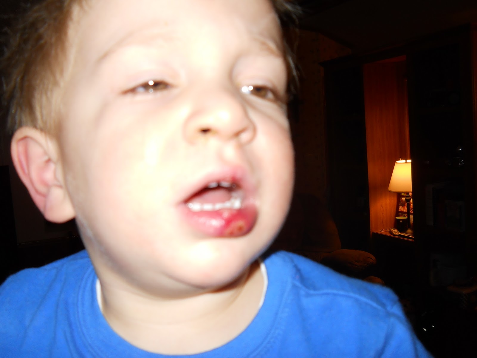 Noah's Nook Busted Lip