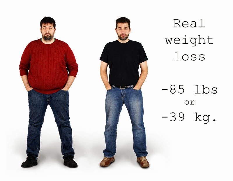 Adjustable Gastric Band Doctors Weight Loss Clinic San Diego Weight