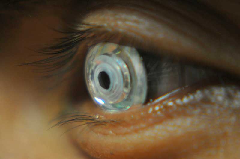 Lentillas con zoom sale