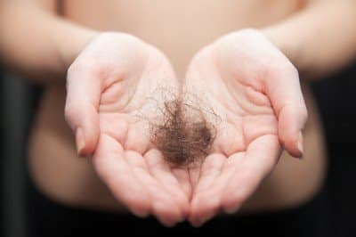 What are the early signs of alopecia?