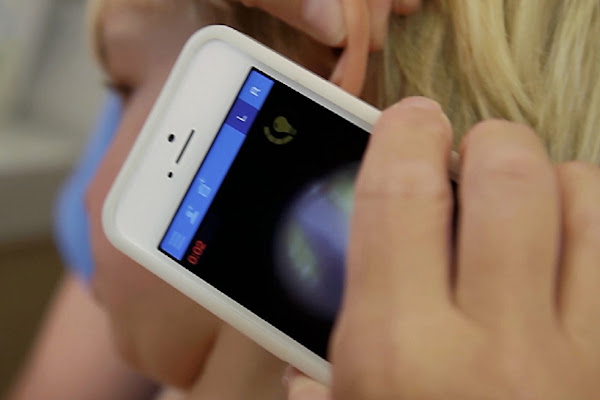 數位時代翻攝自 CellScope 官網