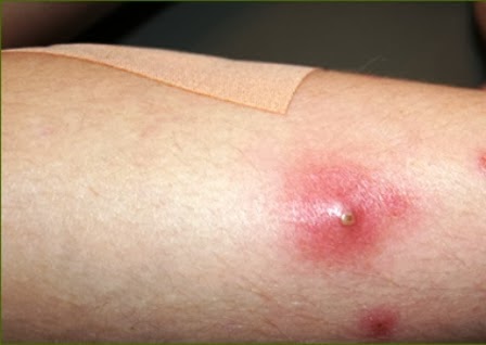 Ternyata Manfaat Daun Sirsak Lebih Besar Daripada Buahnya Loh. Inilah Manfaat dan Cara Memanfaatkannya