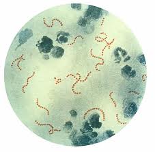 Gram Positive Bacteria, Diseases and How to Differentiate Between Different Groups of Gram Positive Bateria