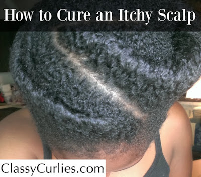 cure itchy scalp