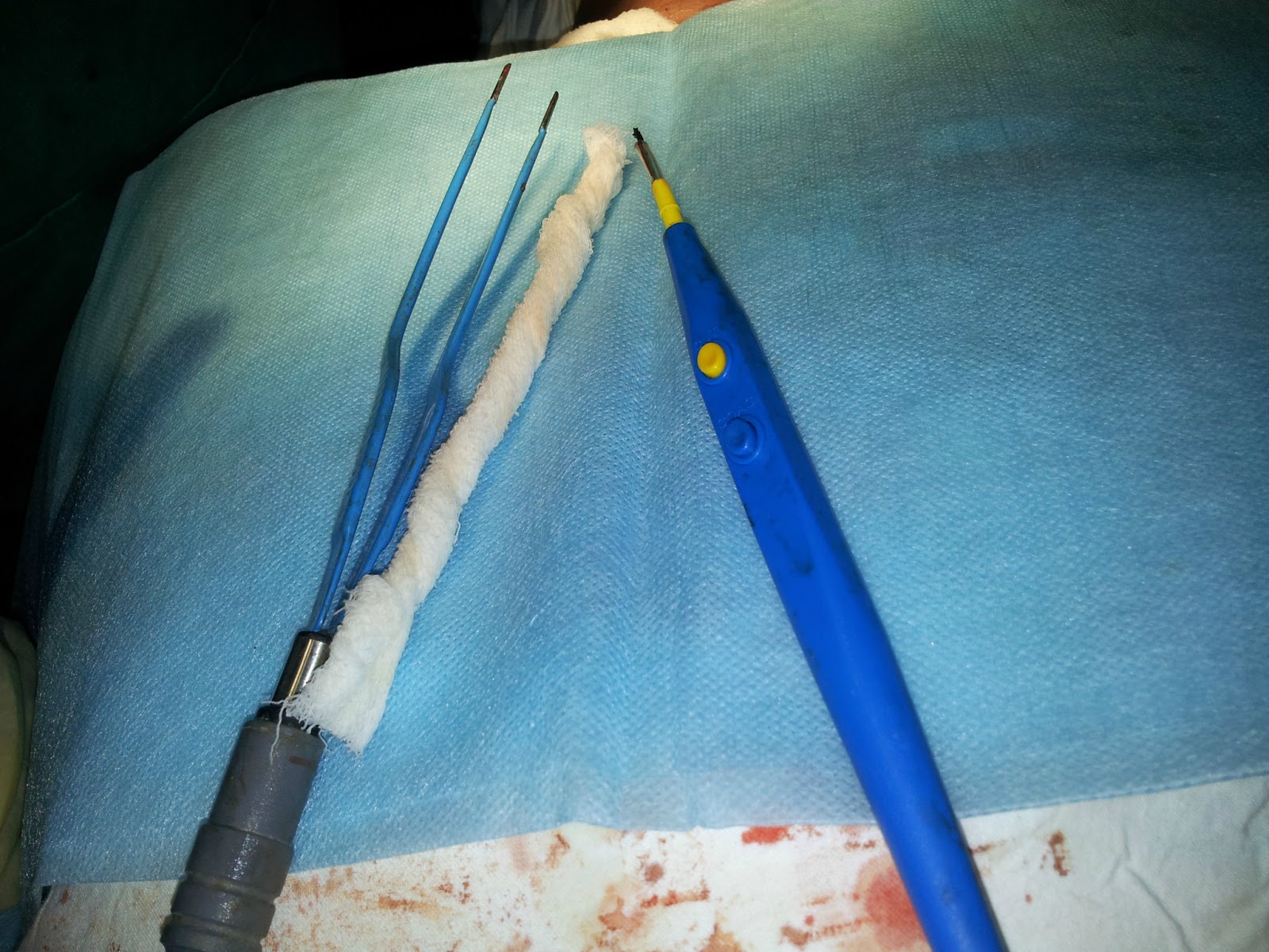 General Surgery Clinics A Surgeon's Blog Types of Diathermy/Cautery in Surgery