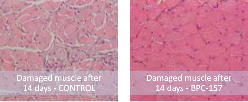 BPC-157, the Orally Available Peptide That Repairs Tendon, Muscle