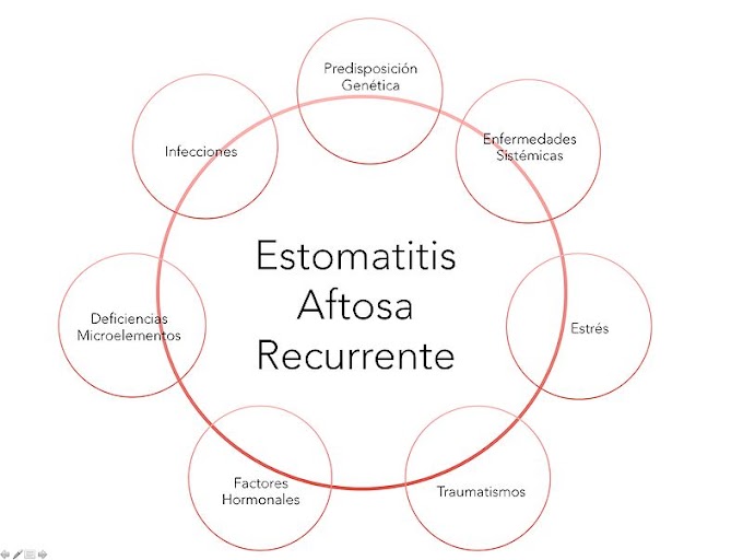 VIDEOCONFERENCIA: Estomatitis Aftosa Recurrente EAR - Dr. Carlos Flugel Dietrich