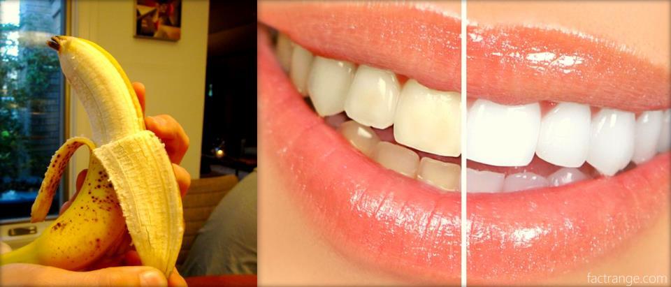 Peau De Banane Dents Blanches Avis fruits de la vie: mai 2016
