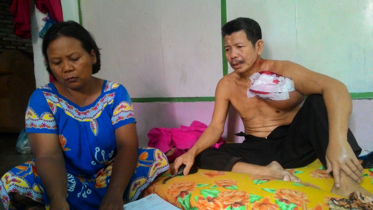 Korban penderita tumor di Labuhanbatu yang membutuhkan uluran tangan para dermawan. Korban penderita tumor di Labuhanbatu yang membutuhkan uluran tangan para dermawan.