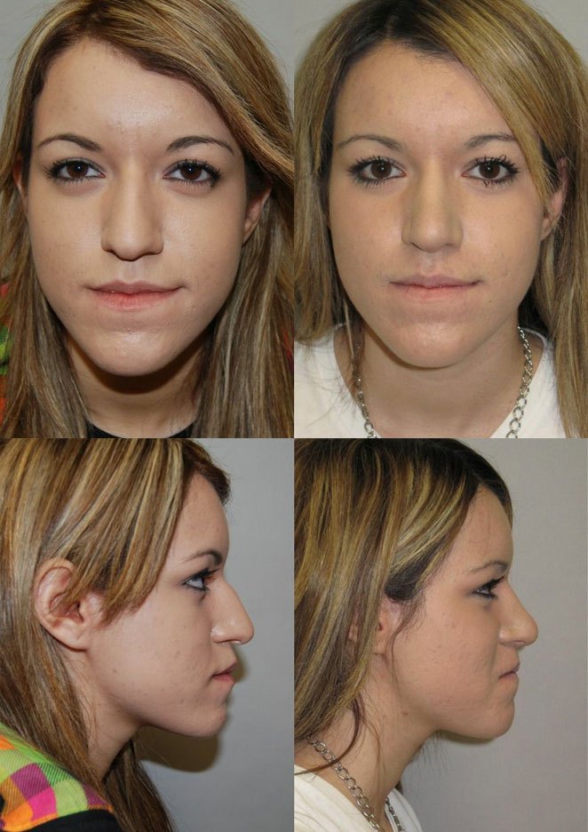 Mark Hamill Nose Job San Diego Jobs Information Center