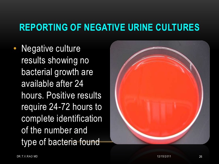 Urine Culture