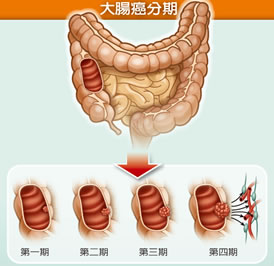 カリウム 過剰摂取 腎臓